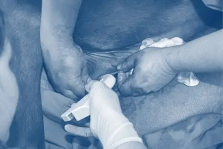Pferde OP-Versicherung hier vergleichen Informieren Sie sich hier zum Thema Pferdekrankenversicherung und Pferde OP-Versicherung zur weiteren Absicherung Ihres Pferdes