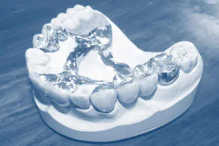 Zahnzusatzversicherung als Erg&auml;nzung zur GKV